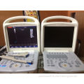 Medical Equipment-Portable Digital Color Doppler Ultrasound Scanner